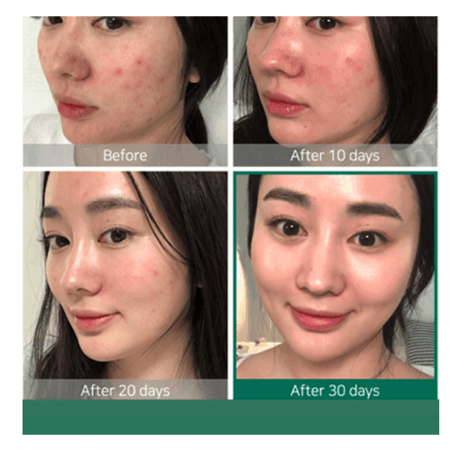 [769915195606] مقشر احماض الفواكه AHA 30% + BHA 2% -من ذا اورديناري 30 مل